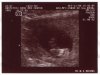 Ultrasound Picture No. 2 - Small version